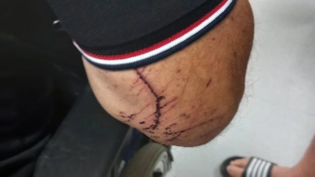 Dhunimi i banorit në Mirditë, policia: Kishte plagë në trup