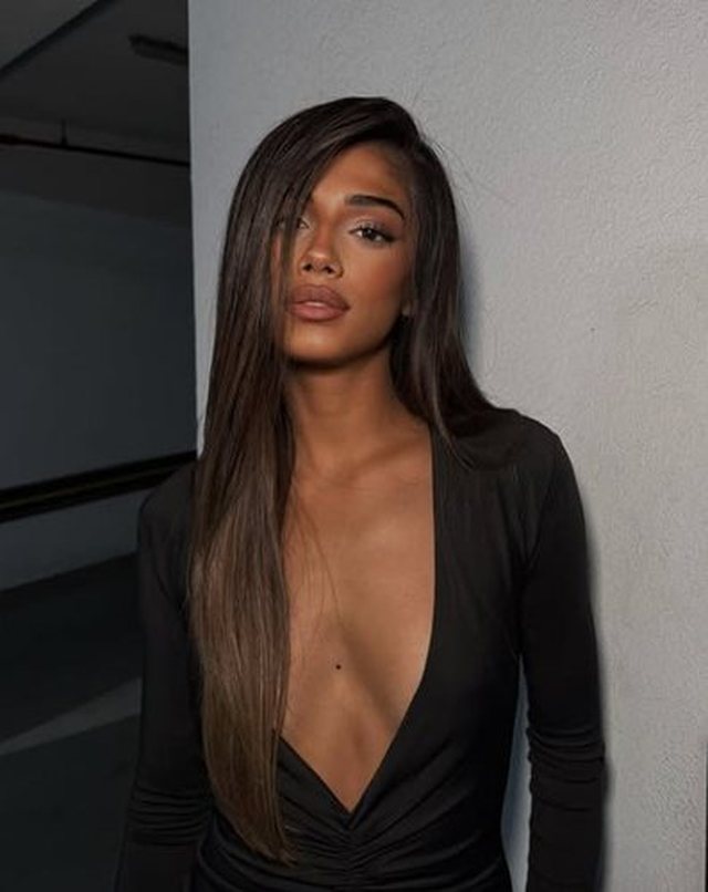 Solidariteti/ Modelja shqiptare pëson hemorragji cerebrale, mblidhet