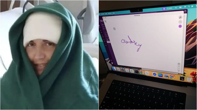 Gruaja e paralizuar shkruan emrin e saj pas 20 vitesh, duke përdorur